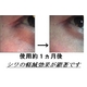 ＥＧＦ美容液　サイトカイン三種配合　「お試し版３ｍｌ」増量！！「スリーＧＦエッセンスＰｒｏ」 - 縮小画像4