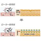 ヒールゲルマツインローラー