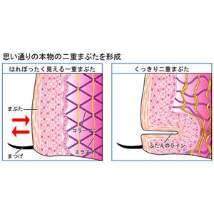 二重まぶた形成器 アイリッドフォールド パールホワイト