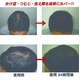 頭皮タンニングローション コロランテ 30ml - 縮小画像4