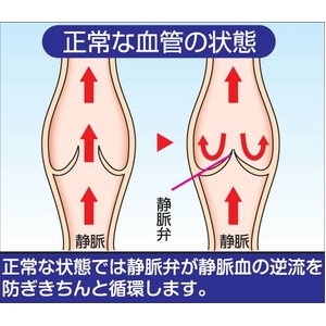 バニティーレッグローション