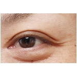 �G�e���i�A�C�R���Z���g���[�g�d�w �摜5