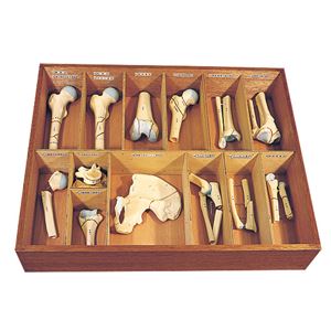 骨折種類模型 【13種】 実物大 木製ケース付き M-131-0 商品写真