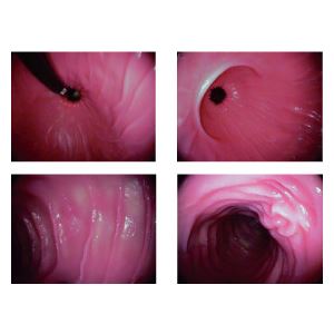 胃・十二指腸内視鏡練習モデル(看護実習モデル人形) 胃・十二指腸/洗浄・交換可 M-135-0 商品写真2